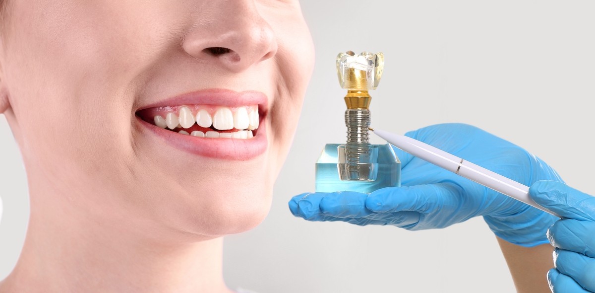 Comfortable bone grafting services to ensure your oral health in Palm Desert, CA