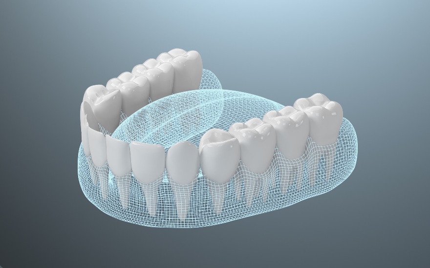 Precise and comfortable 3d digital impressions dental technology in Palm Desert, CA. Contact us today.