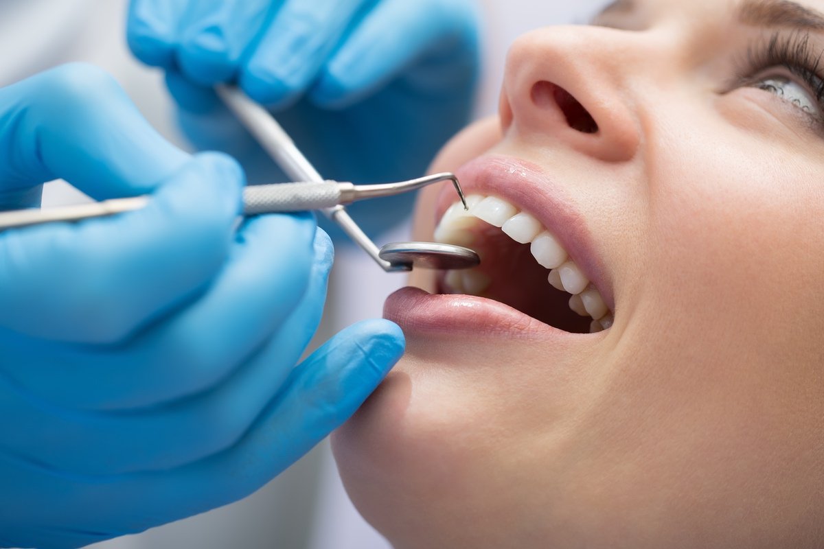 Woman undergoing a frenectomy while getting her teeth cleaned by a dentist in Palm Desert, CA<br />
